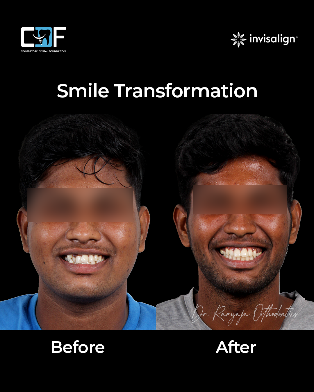 Before After Result